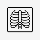 흉부 X-ray AI